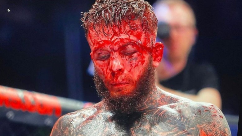 Jordan Vucenic is bloody, deformed after the match in the MMA Cage Warriors - Photo 2