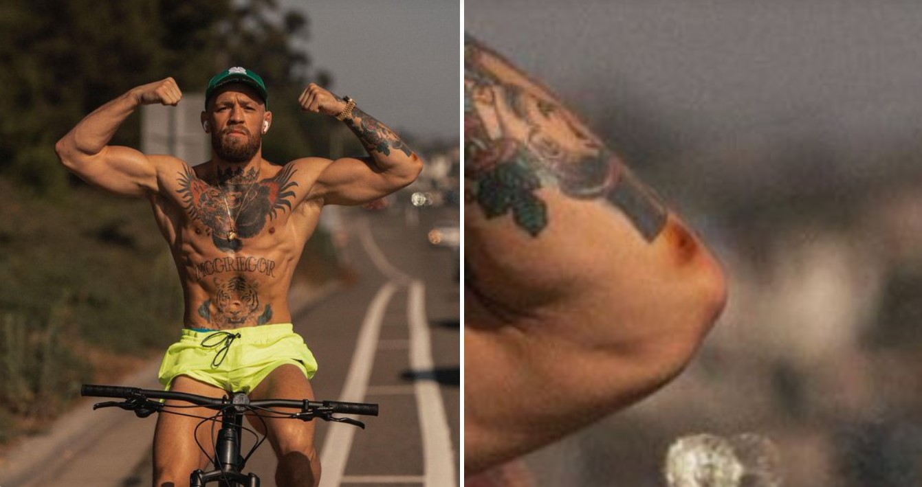 Conor McGregor is likely to be infected with staph infection before the trilogy battle with Dustin Poirier - Photo 2