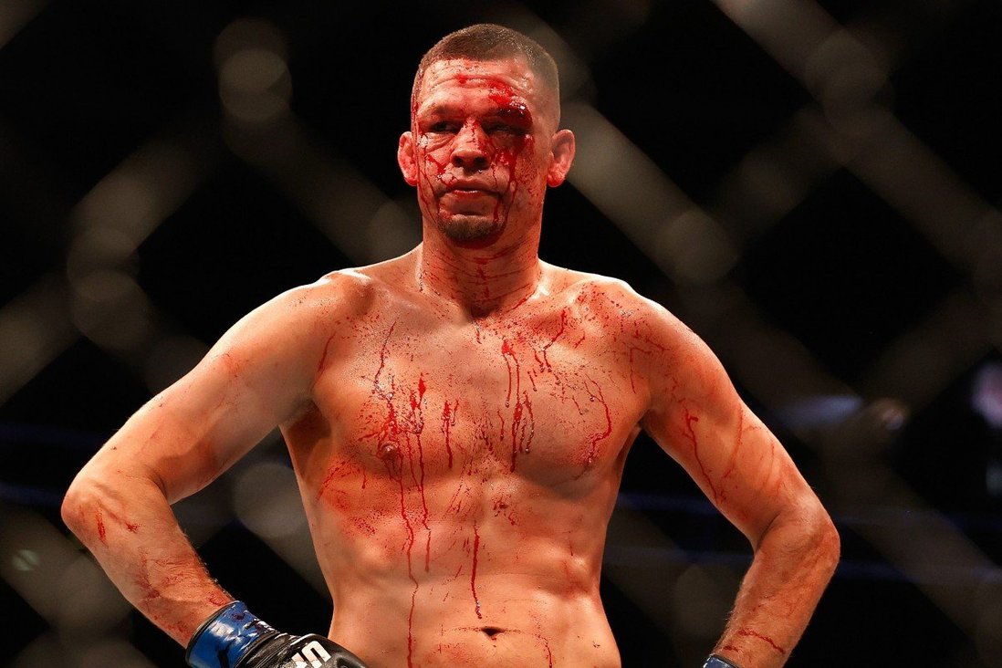 Nate Diaz lost by 'lost motivation' to fight Leon Edwards from a month ago - Photo 3