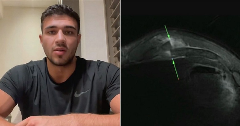 Jake Paul: Tommy Fury is injured just because of training with Tyson Fury - Photo 3