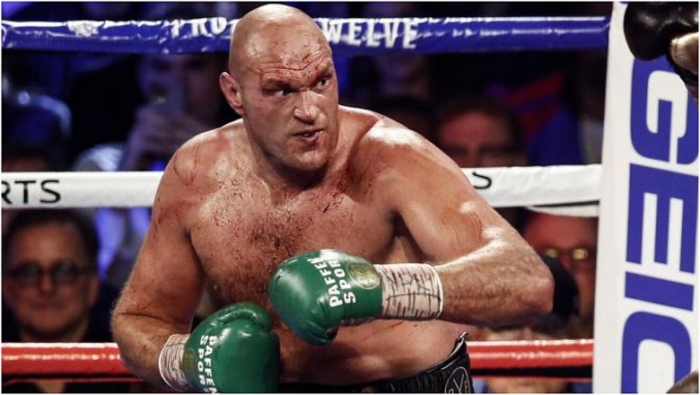 Tyson Fury will protect the WBC championship before Dillian Whyte after many evidence - Photo 2