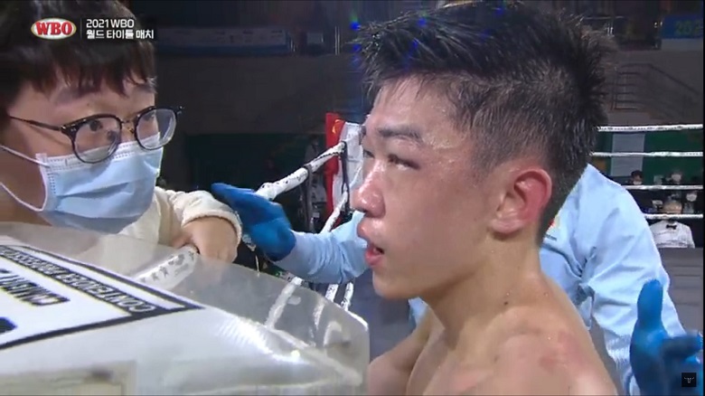 Sam Minh Phat stopped in the 7th half, lost the title of WBO Oritental - Photo 3