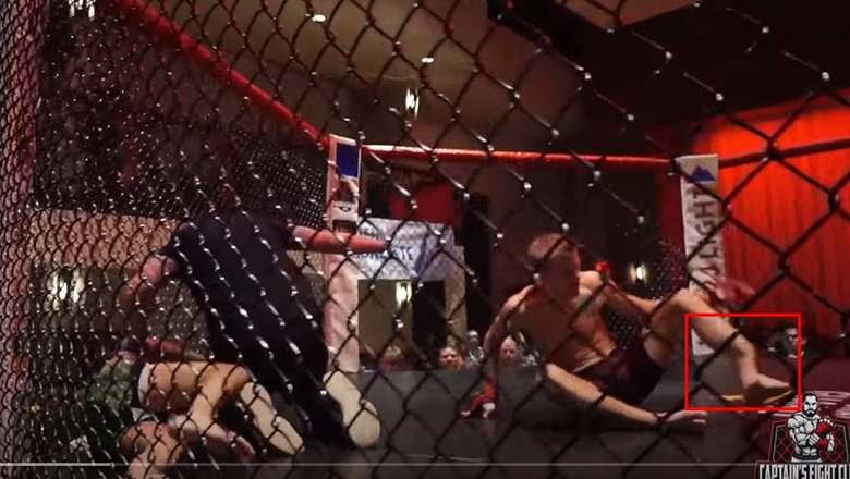 Copy of the broken leg of Conor McGregor appears in an amateur match - Photo 1