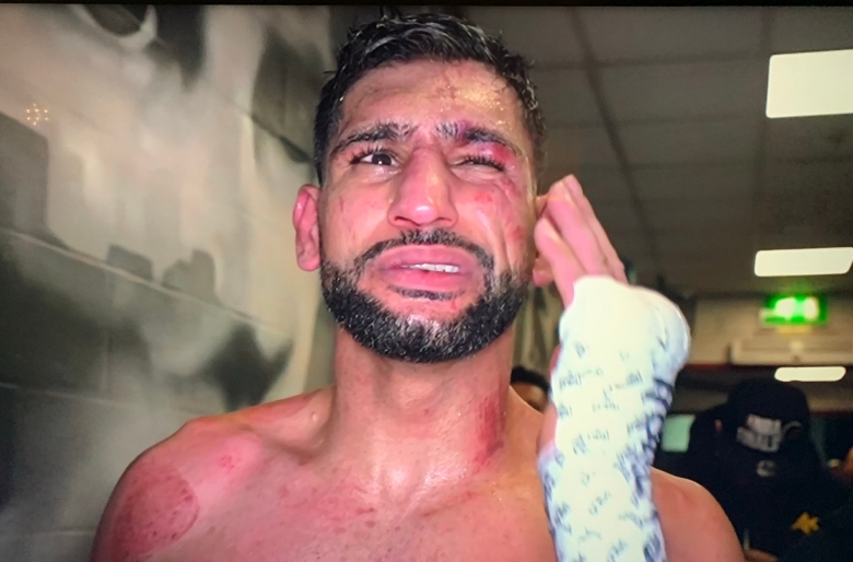 Amir Khan opened the retired story after the defeat of Kell Brook - Photo 1