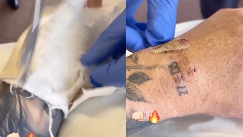 Canelo Alvarez risks 1 year after hand surgery - Photo 1