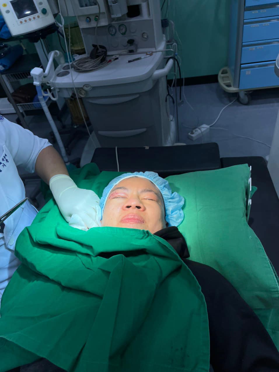 Champion Nguyen Thi Thu Nhi stitched 5 stitches after the battle of WBO belt - Photo 2