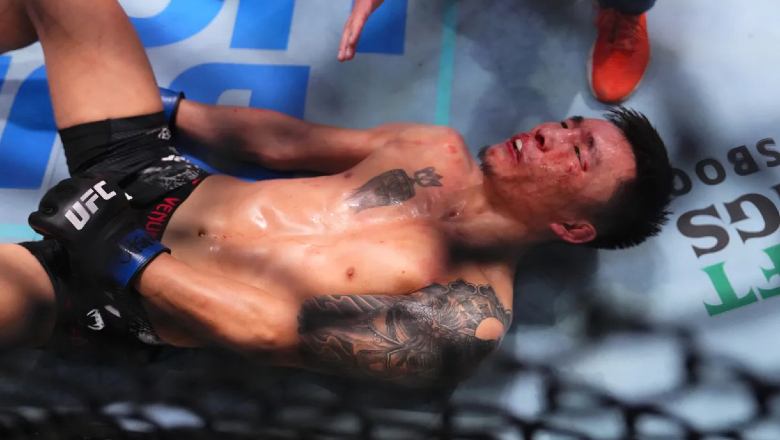 Chinese UFC boxers were hospitalized for receiving 2 attacks - Photo 1