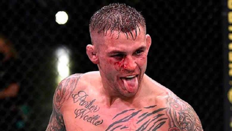 Conor McGregor, Dustin Poirier and charity story 500,000 USD: All developments - Photo 4