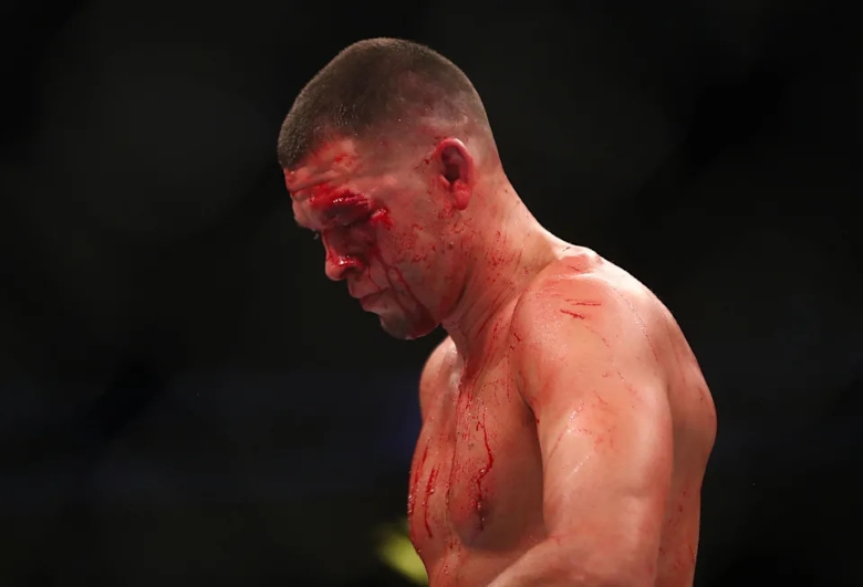 Dana White does not know what to do with Nate Diaz after the defeat at UFC 263 - Photo 1