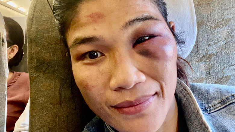 Female boxer wearing ao dai to share bruises after reaching the final of Lion Championship - Photo 1