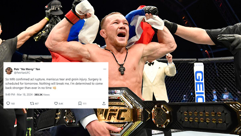 Petr Yan seriously injured had surgery after the victory at UFC 299 - Photo 1