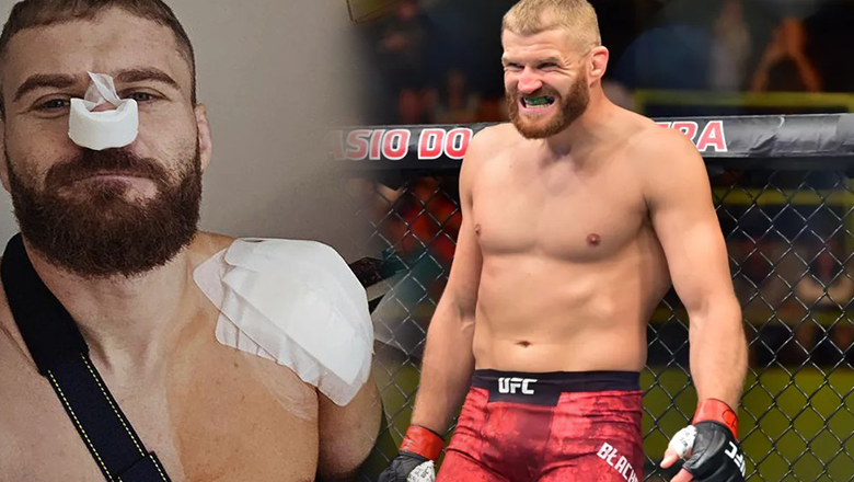 The former UFC championship for the second shoulder surgery to return to MMA - Photo 1