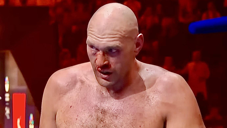 Tyson Fury believes I'm the winner of Usyk - Photo 1