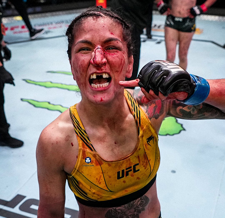 UFC female star broke the nose, broken 2 incisors after winning at the 'Fight Night' event - Photo 1
