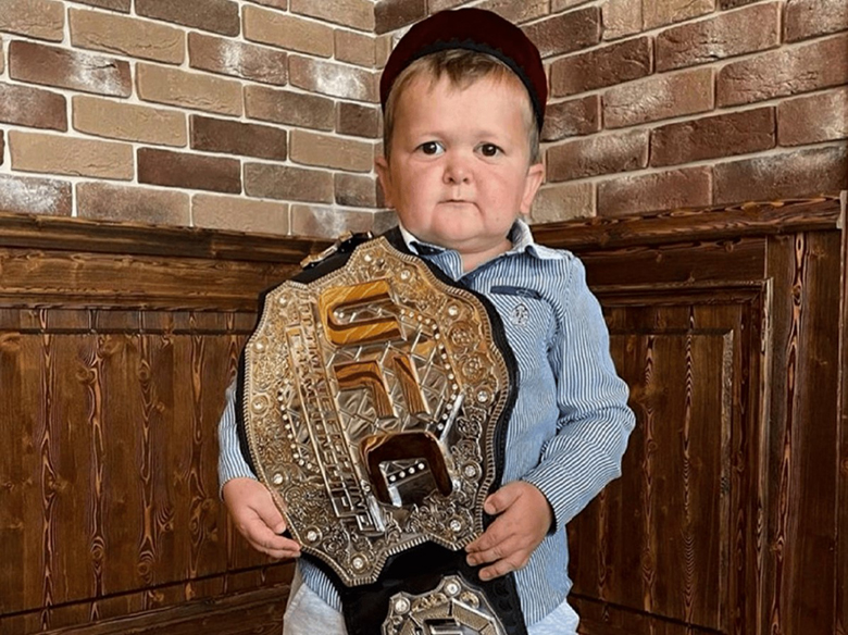 Who is Hasbulla Magomedov? How old is the tiny boxer contract with UFC? - Photo 2