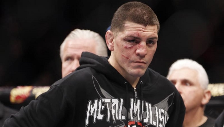 Nick Diaz will refuse young star Khamzat Chimaev: Not enough to play Superfight! - Photo 1
